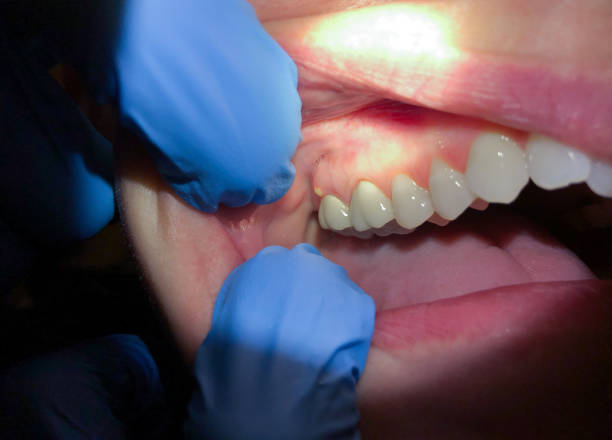 Best Same-Day Emergency Dental Services in Higganum, CT