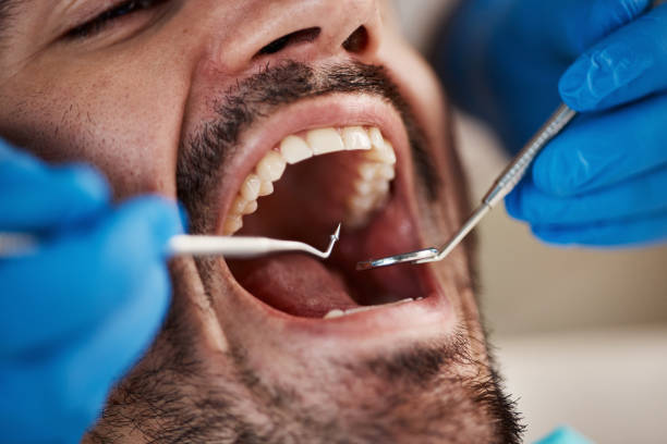 Best Same-Day Emergency Dental Services in Higganum, CT